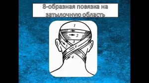 Десмургия. Мягкие повязки. Кафедра общей хирургии ФГБОУ ВО ТГМУ