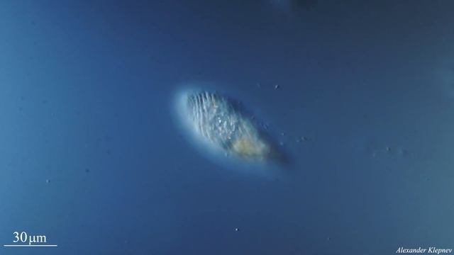 Unknown ciliate смотреть онлайн