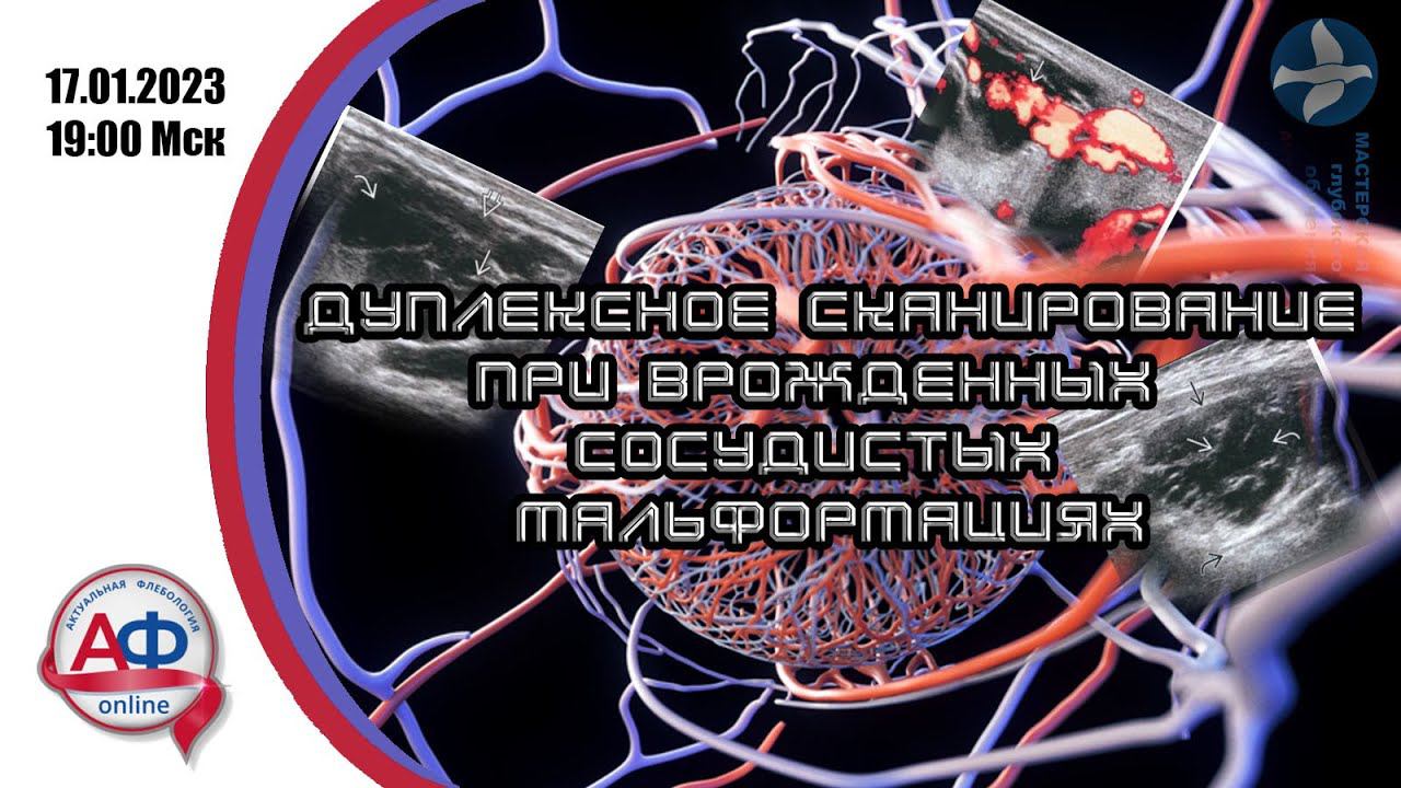 Дуплексное сканирование при врожденных сосудистых мальформациях смотреть онлайн