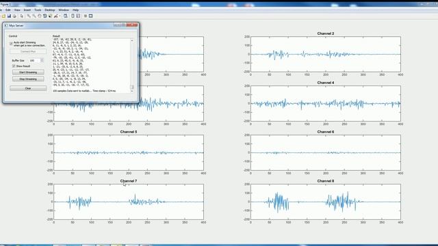 Myo Armband reading raw 8 channel raw EMG data смотреть онлайн