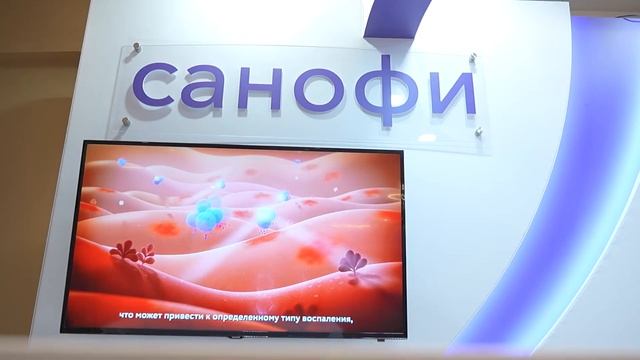 XXХ Конгресс Европейского союза фониатров в Турции смотреть онлайн