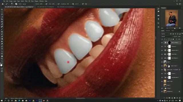 Most Realistic Teeth Whitening in less than 5 minutes in Photoshop (part 1) смотреть онлайн