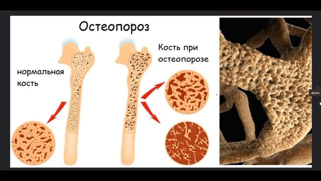 Суставы.