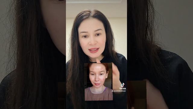 как я избавилась от прыщей! #акне #постакне #прыщи смотреть онлайн