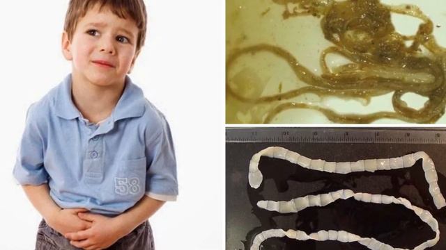 Моментальное выведение ГЛИСТОВ и ПАРАЗИТОВ. Как вывести паразитов из организма смотреть онлайн