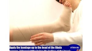 Правильное наложение эластичного бинта