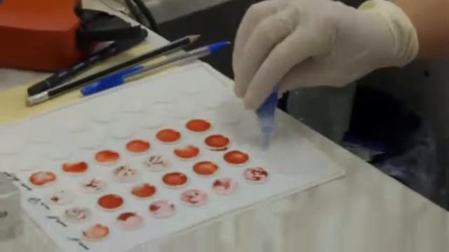 Как корни сдавали кровь ! Подробное видео ! смотреть онлайн