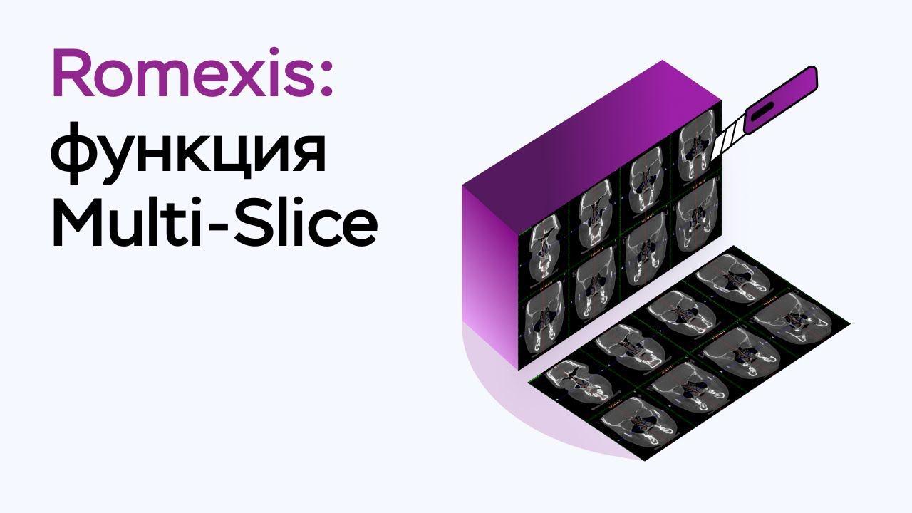 Возможности программы Romexis Viewer: функция Multi-Slice смотреть онлайн