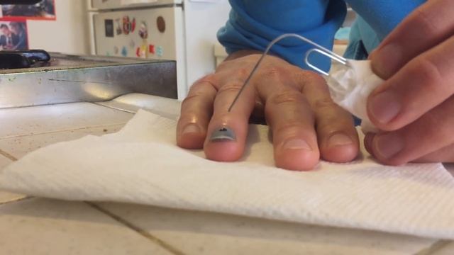 Smashed Fingernail Blood Draining: DIY Surgery смотреть онлайн