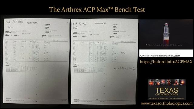 The Arthrex ACP MAX Platelet Rich Plasma (PRP) Bench Test смотреть онлайн