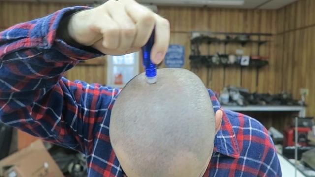 15 Months Of Rosemary Oil For Hair Loss: It Turns My Skin Red?