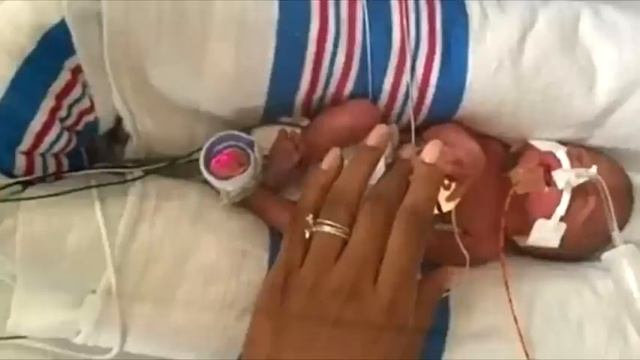 На ночь мать прикрыла недоношенного сыночка перчаткой. На утро случилось невероятное! смотреть онлайн