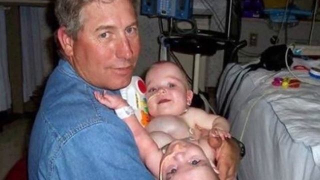 От них отказались родители из за врожденной особенности.. Вот как сложилась их судьба спустя 15 лет смотреть онлайн