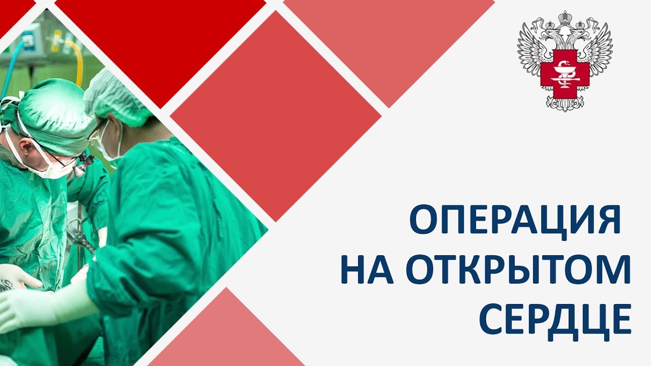 Операция на открытом сердце смотреть онлайн