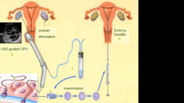 KELAS FERTILITAS ONLINE 18 OKTOBER 2014 смотреть онлайн