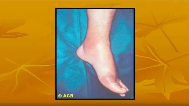 Dr Pradeep Kumar(Rheumatologist) at I-AIM Healthcare Center смотреть онлайн