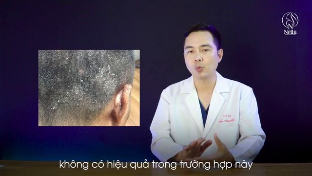 Vì sao TIÊM ĐIỀU TRỊ RỤNG TÓC không hiệu quả? смотреть онлайн