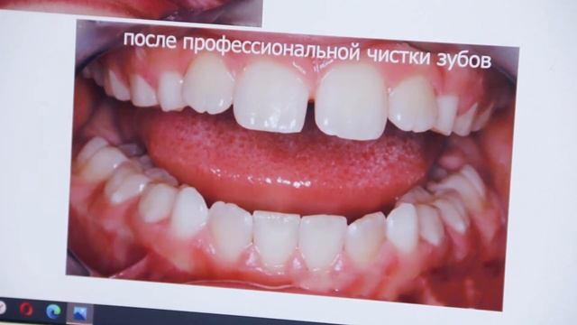 Лучший молодой врач области 20 г о "черном налете" у детей. Телемедицина. смотреть онлайн