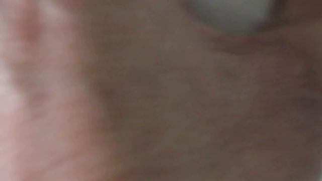 A Jack Russell has swollen lymph nodes - lymphoma? смотреть онлайн