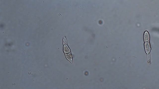 Белая ржавчина хризантем (Puccinia Horiana Henn.)