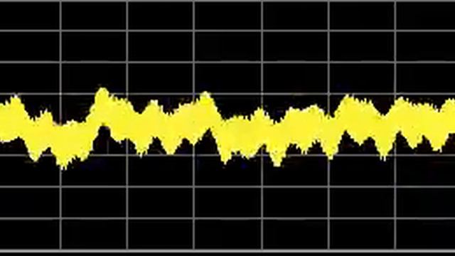 Weight Loss - Rife Frequencies