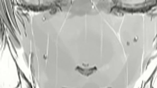 [ AMV ] Hurt - USUK [ APH ]