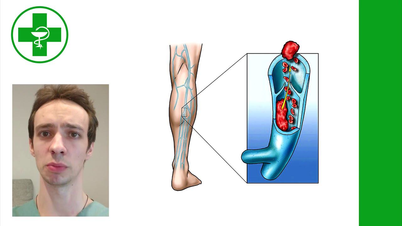 Нутритивная (питательная) поддержка онкологических пациентов: амарант и лебеда смотреть онлайн