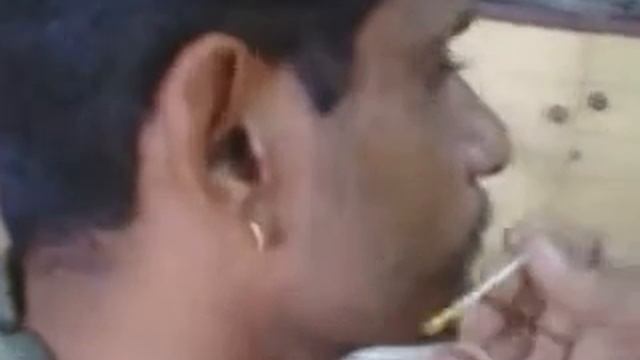 Wart-X Lotion Usage Procedure