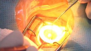 Кросслинкинг