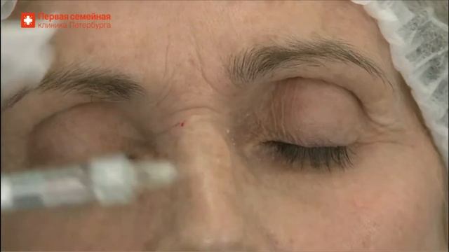 Процедура бланшинга смотреть онлайн