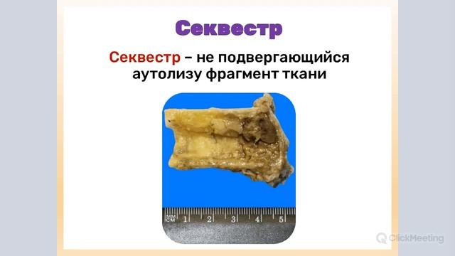 Клинико-анатомические формы некроза | Патологическая анатомия смотреть онлайн