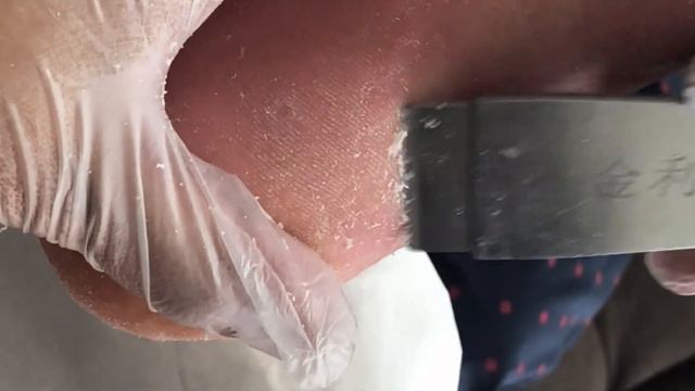 Dry soles, clean up the skin of the feet, a pregnant mother【Foot Scalpel】 смотреть онлайн