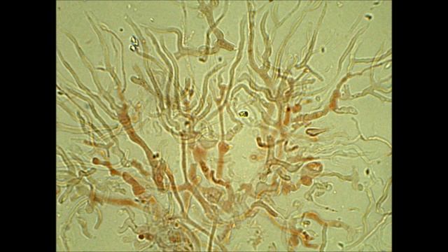 Exidia saccharina Fr. (1822) смотреть онлайн