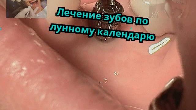 Лечение зубов по лунному календарю смотреть онлайн