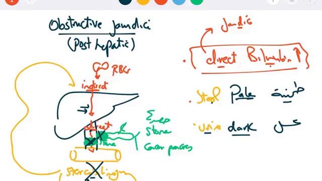 GIT 6 - liver part 2 jaundice смотреть онлайн