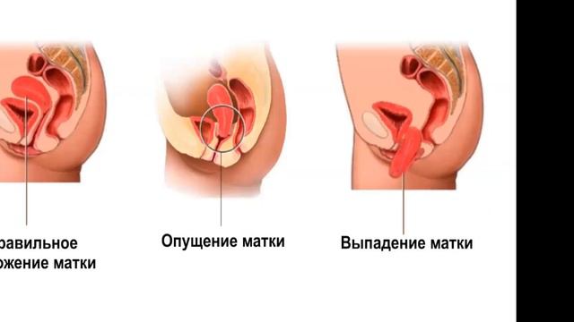 Йога и восстановление после родов2023060