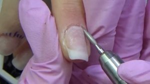 Обработка кутикулы аппаратом