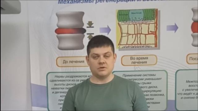 Отзыв пациента о лечении спины на роботе SPINE MT.