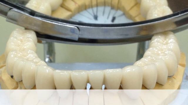 Металлокерамические коронки . протезирование коронками , бюгельный протез , нейлоновый протез смотреть онлайн