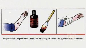 Какую рану можно мазать йодом? Можно ли йодом обрабатывать открытую рану?