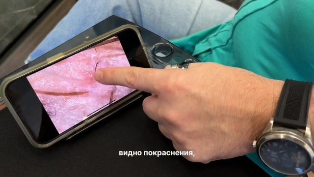 Почему выпадают волосы? смотреть онлайн