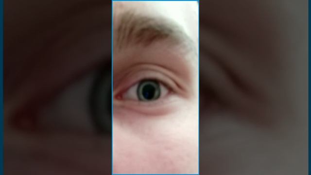 Увеличение зрачка смотреть онлайн