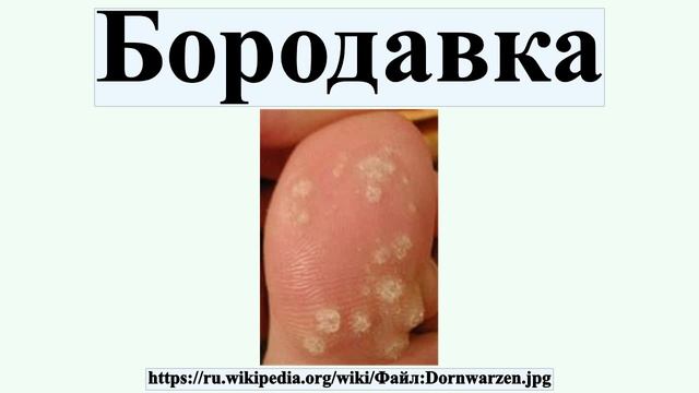 Бородавка смотреть онлайн