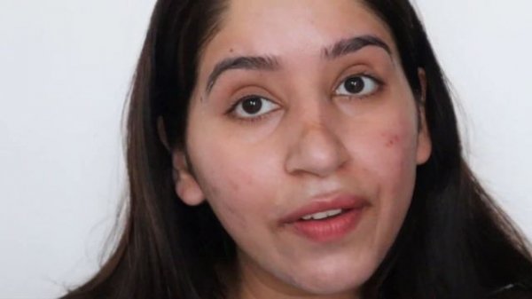 Bioderma Sensitive Dry Skin SPF 50+ Review and Application | Bioderma Photoderm Creme Sunscreen