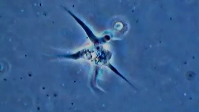 Identify this microorganism in the All Microscope Forum смотреть онлайн