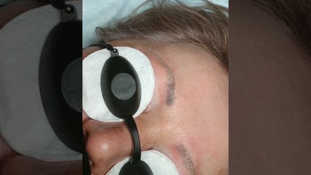 Лазерное удаление татуажа бровей Оренбург смотреть онлайн