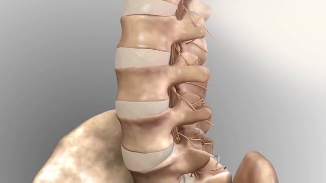Chronic Low Back Pain : Understanding lower back structures and treatment approaches смотреть онлайн