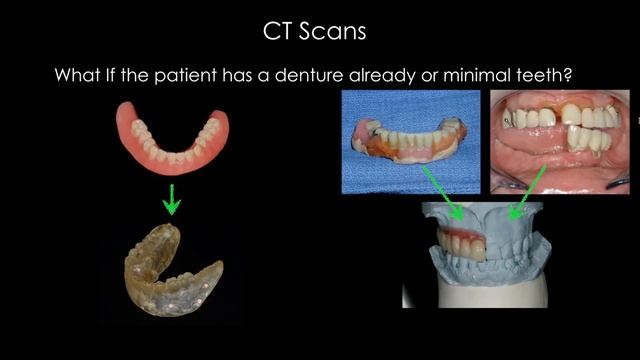 ALL ON 4 LECTURE смотреть онлайн