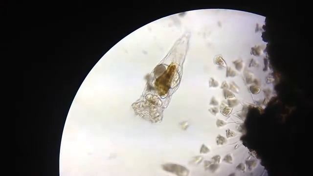 Работа бактерий под микроскопом. смотреть онлайн