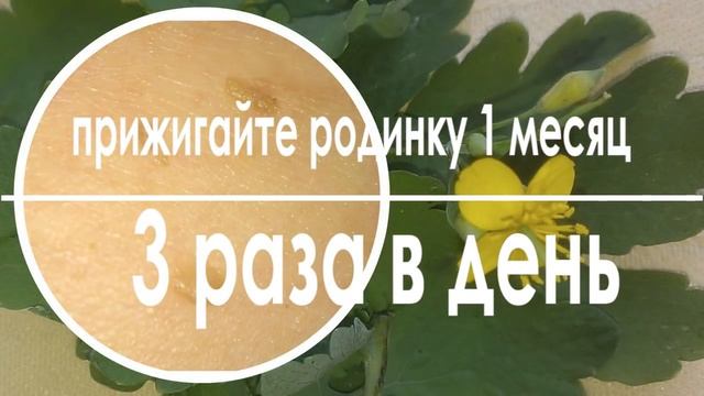 Как удалить родинку в домашних условиях смотреть онлайн